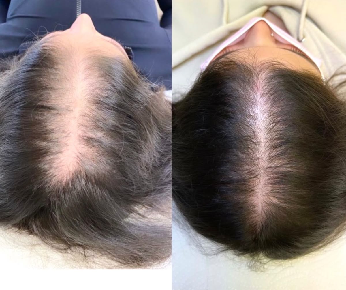 🌿¡Nuevo! CreceCabello Mielle Hair Plus™ - Recupera fuerza y volumen en 7 Dias✨