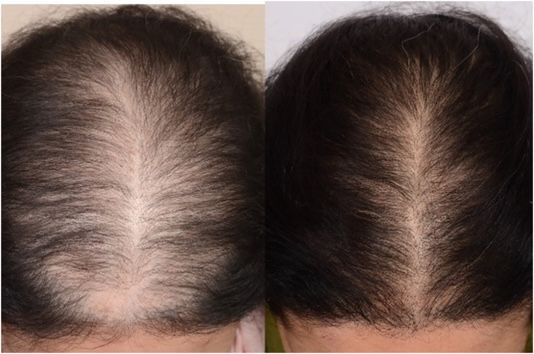 🌿¡Nuevo! CreceCabello Mielle Hair Plus™ - Recupera fuerza y volumen en 7 Dias✨